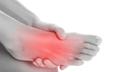 Et billede der viser med rød, hvor smerten sidder i foden, hvis du har slidgigt i foden.
