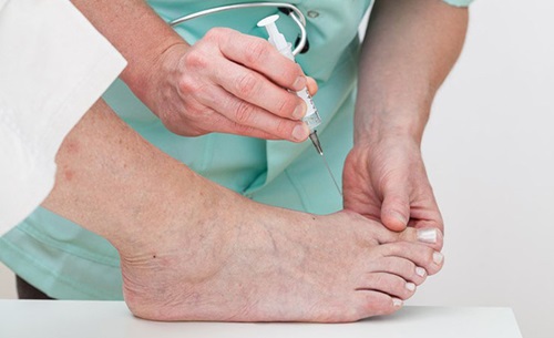 En patient får en blokade i foden.