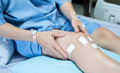 En patient holder sig til sit knæ med et overrevet korsbånd