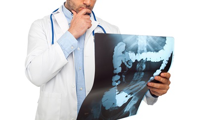 Mandlig læge kigger på et fotografi at en undersøgelse for tarmkræft