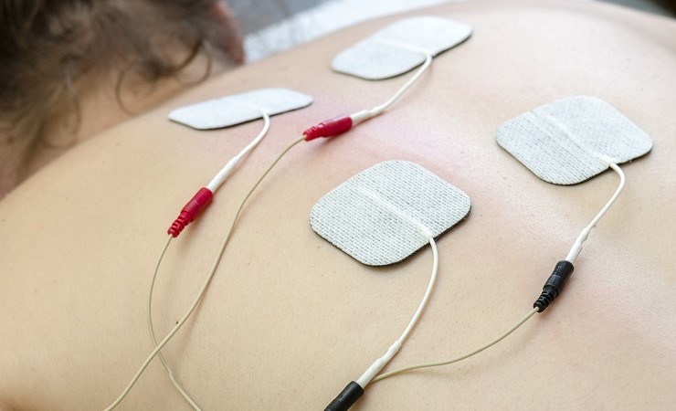 En kvinde har elektroder på ryggen til en EMG undersøgelse, som ligger under emnet neurofysiologi.